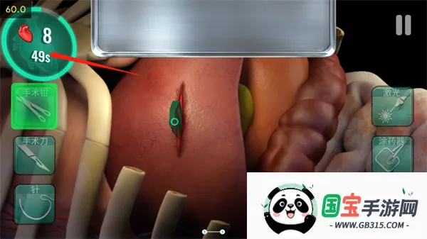 ҽԺ����ʱ��(����ģ����Ϸ)